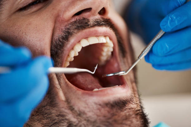Best Emergency Care for Gum Disease in Verandah, FL